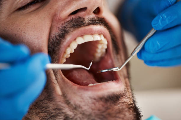 Best Emergency Dental Care for Broken or Chipped Teeth in Norco, LA