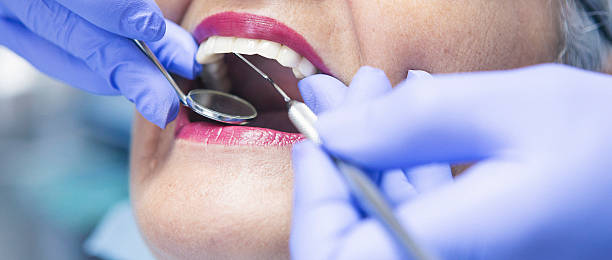 Best Emergency Treatment for Dental Infections or Abscesses in Norco, LA